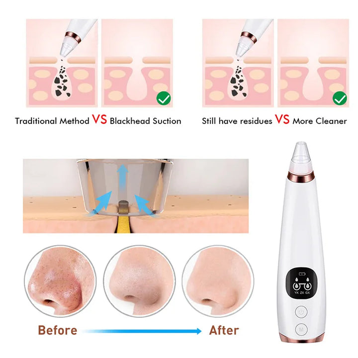 Repairman  Pro: Electric Blackhead Remover